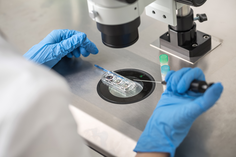 Embryo grading Embryo grading