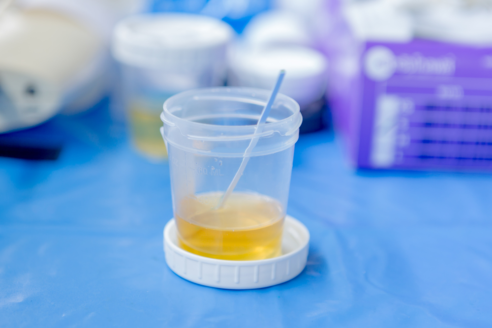 Ovulation urine test Ovulation urine test