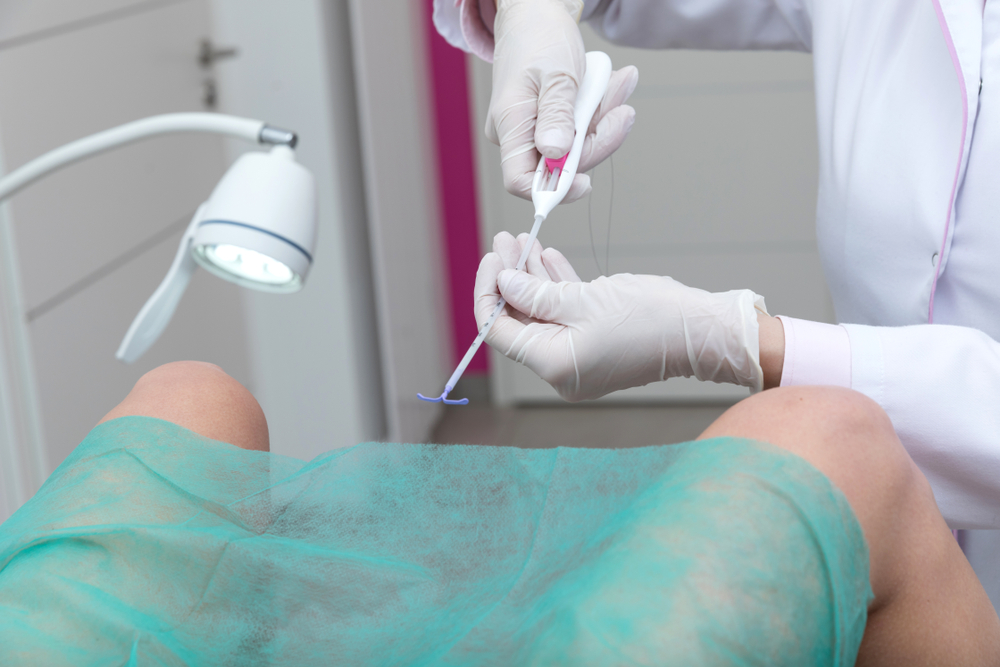 inserting an IUD inserting an IUD