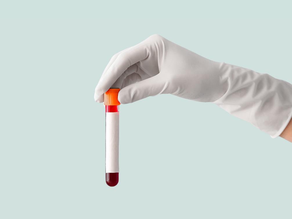Blood STI test