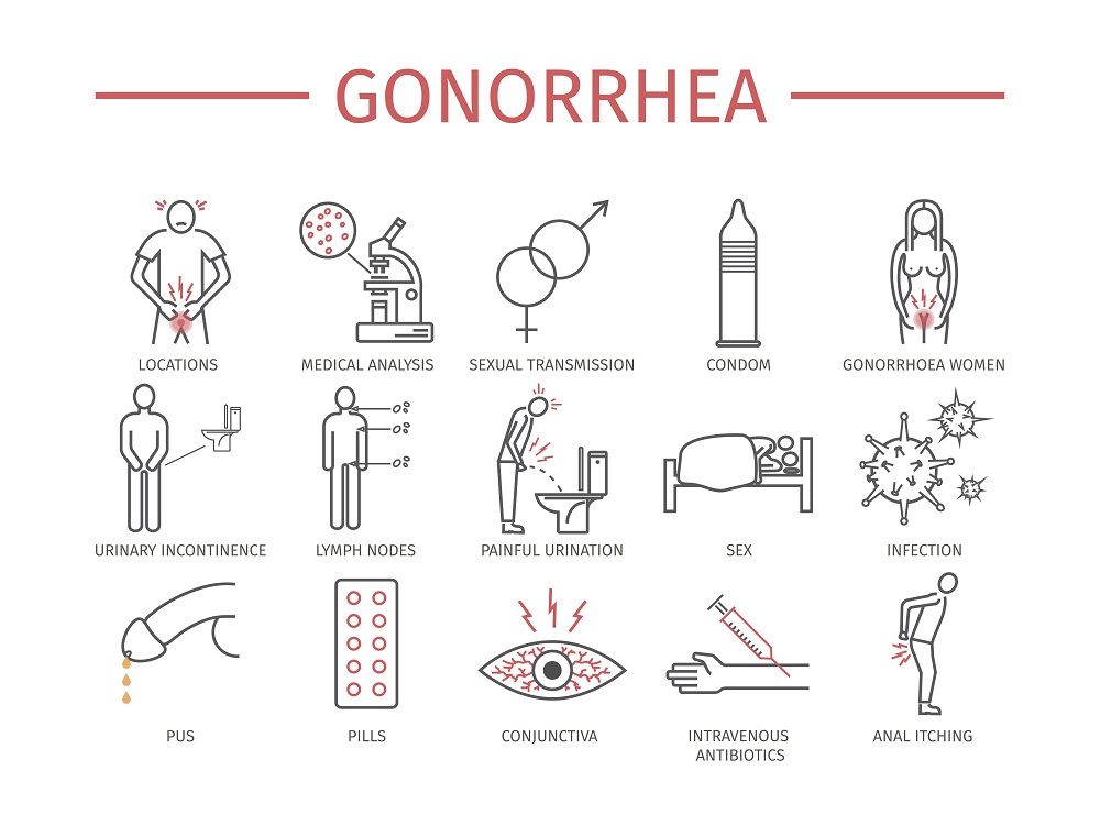 Signs and transmission of gonorrhea Signs and transmission of gonorrhea