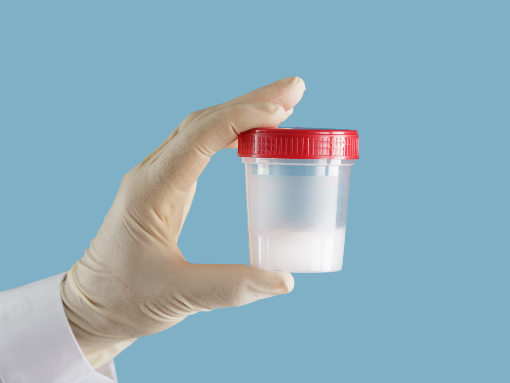 How Does Sperm Donation Work?