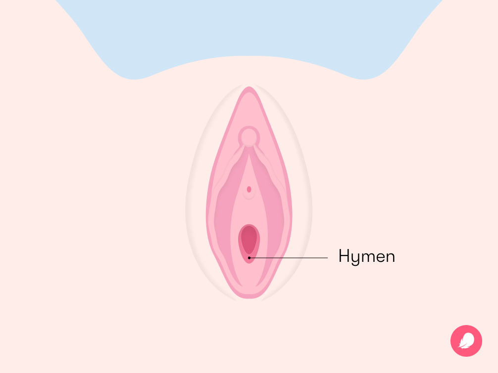 What is a hymen, and what does it look like?