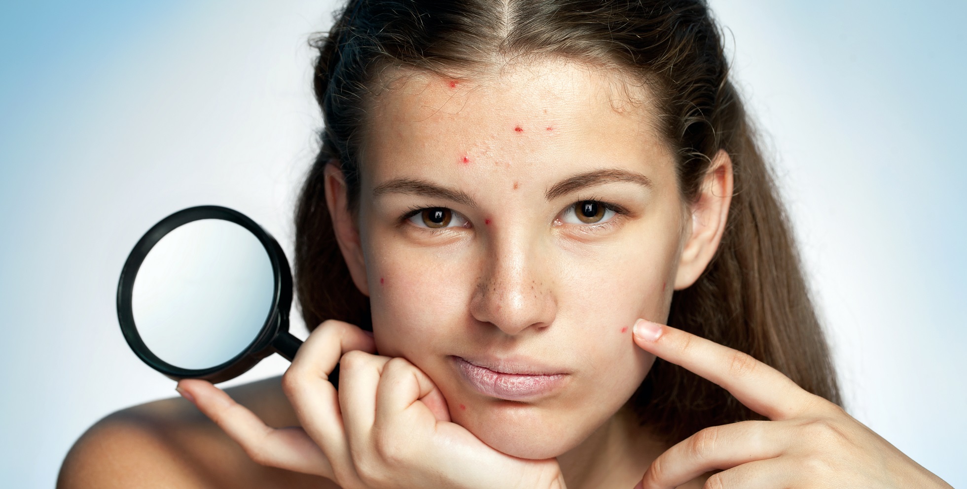 girl with skin problems
