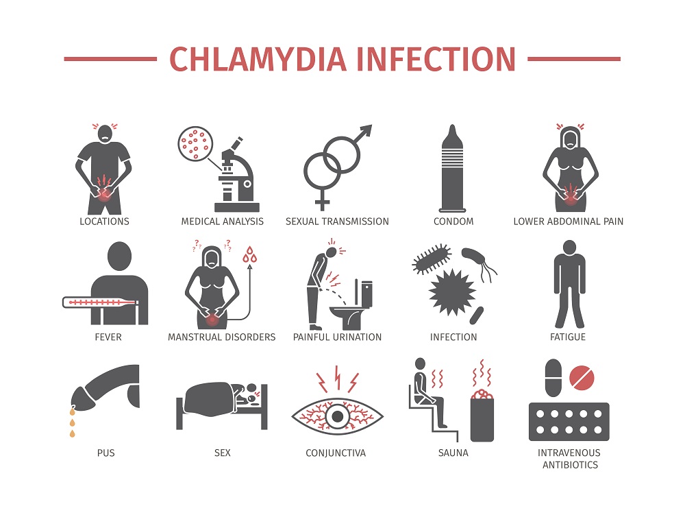 All the manifestations of chlamydia infections All the manifestations of chlamydia infections