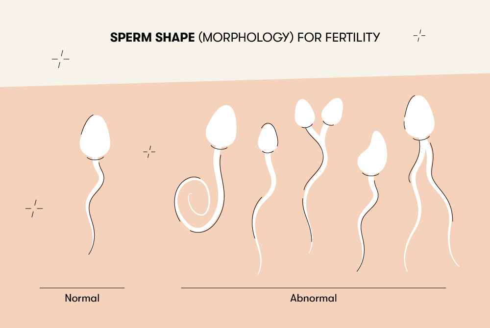 How Much Sperm Does It Take To Get Pregnant Semen Quality Explained