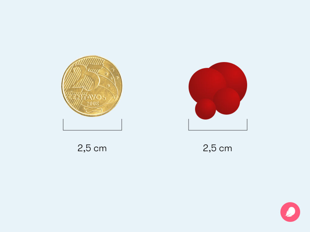Comparação entre os tamanhos do coágulo menstrual e uma moeda de 25 centavos