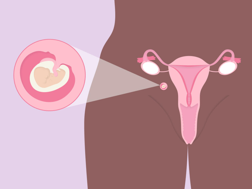 abdominal pregnancy