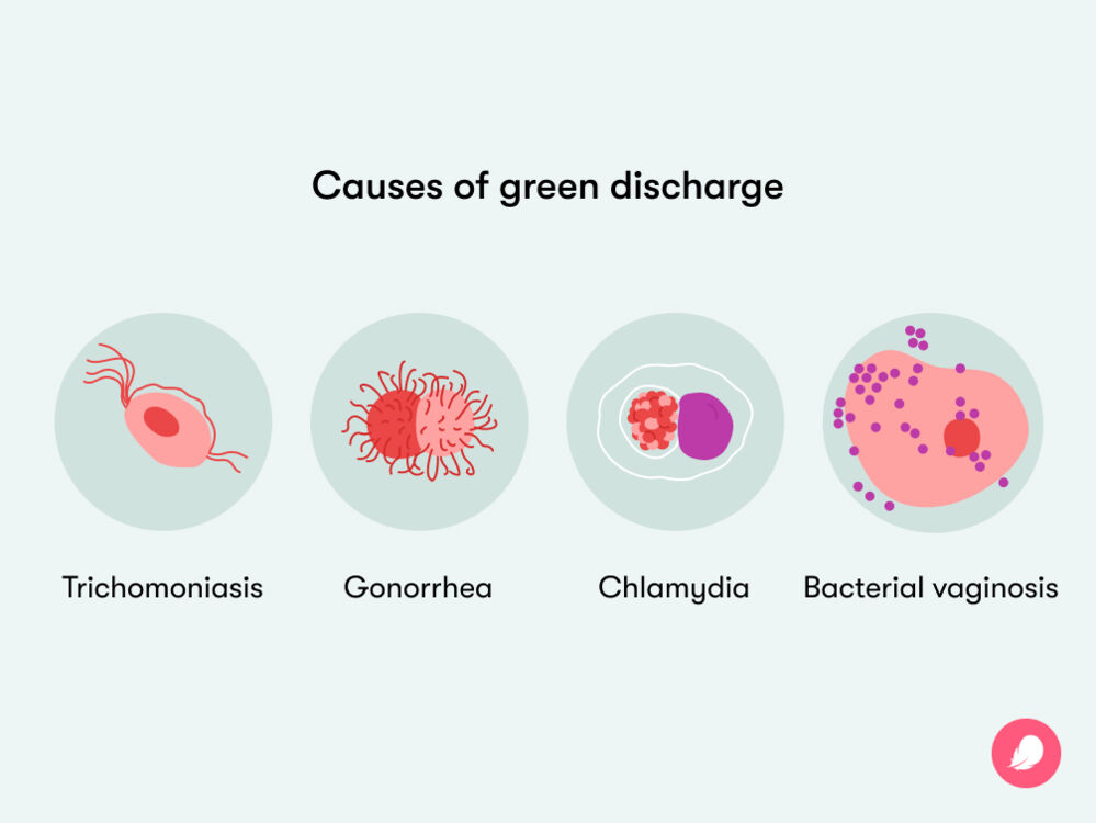 Some of the causes of green vaginal discharge