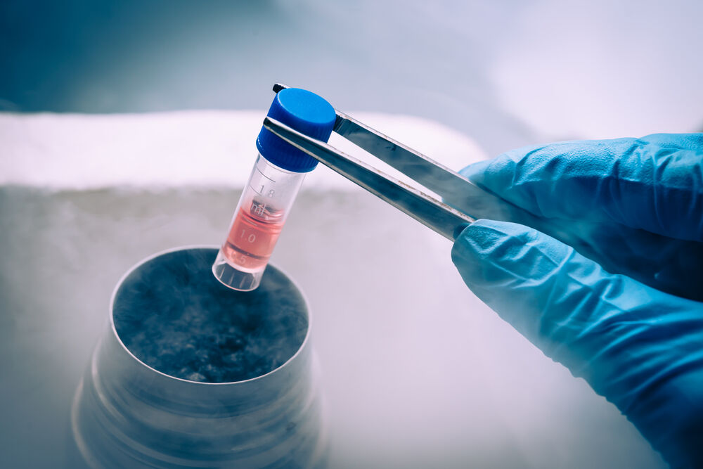 Cryopreservation of cells