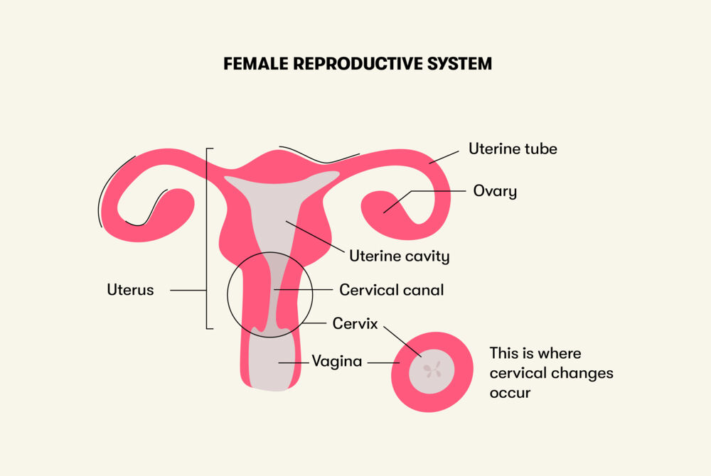 Infographic illustrating the components of the female reproductive system, emphasizing the location of the cervix and areas where cervical conditions may arise.