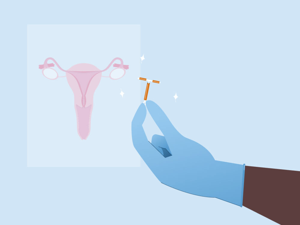 Non hormonal birth control - copper IUD