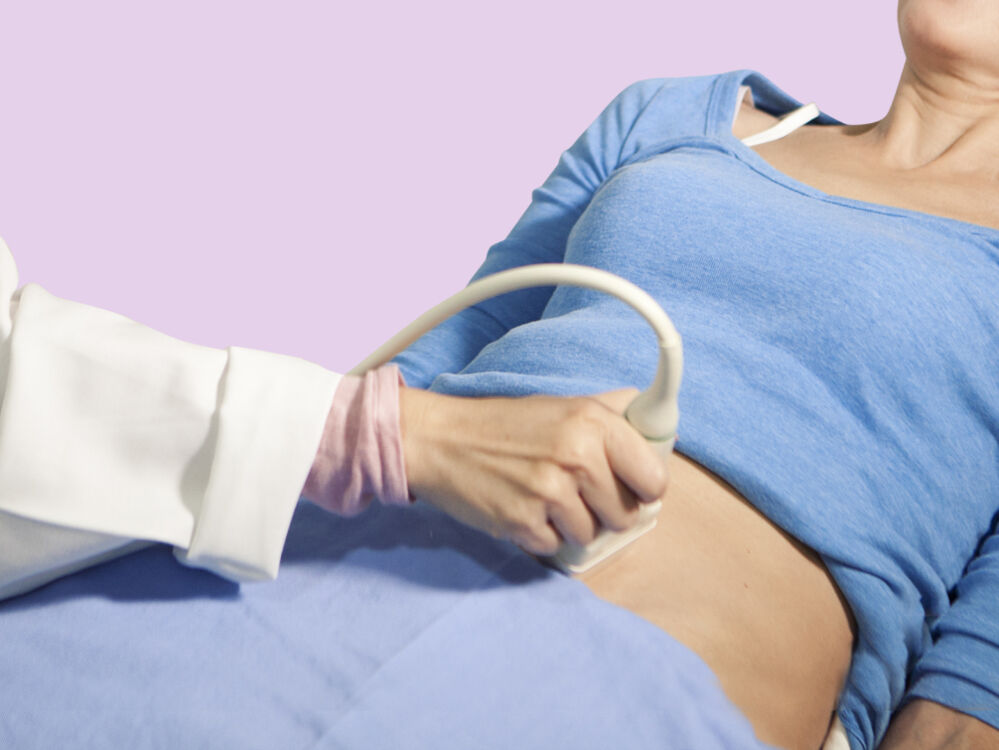 abdominal pregnancy