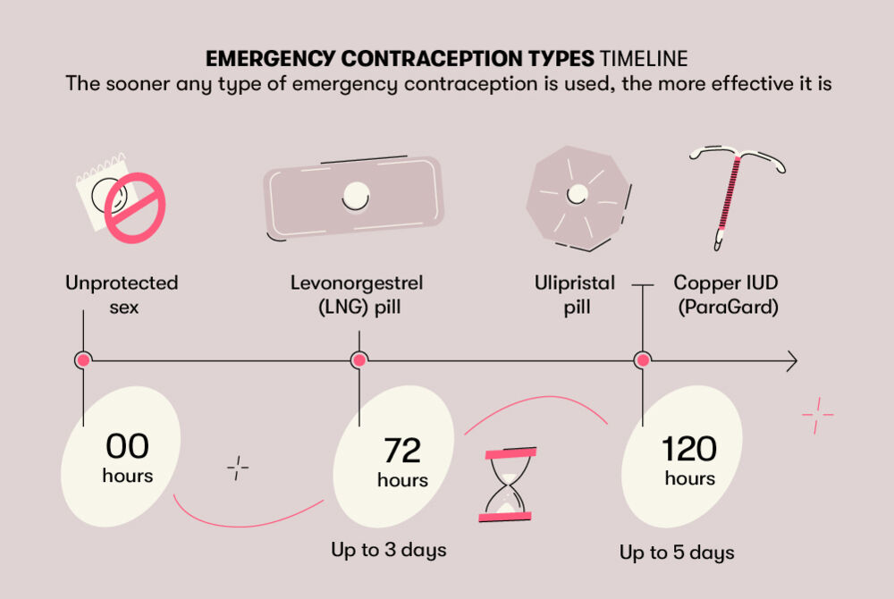 Levonorgestrel, a form of emergency contraception, can be effective up to three days after unprotected sex, while other methods such as ulipristal and a copper IUD can be effective up to day five