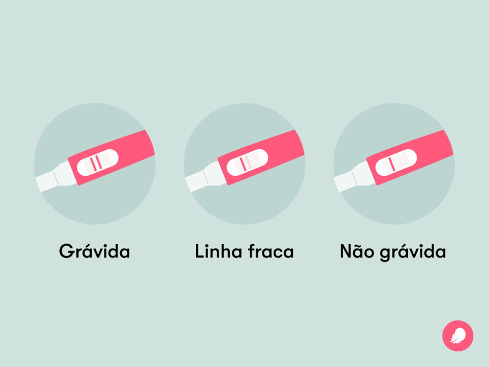 Ilustração de testes de gravidez com os três resultados: duas linhas (grávida), linha fraca e uma linha (não grávida)