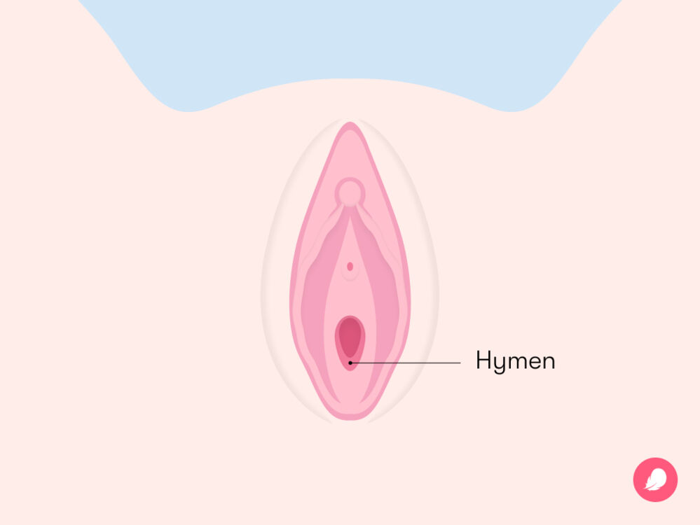 the anatomy of hymen and where it is in the vagina