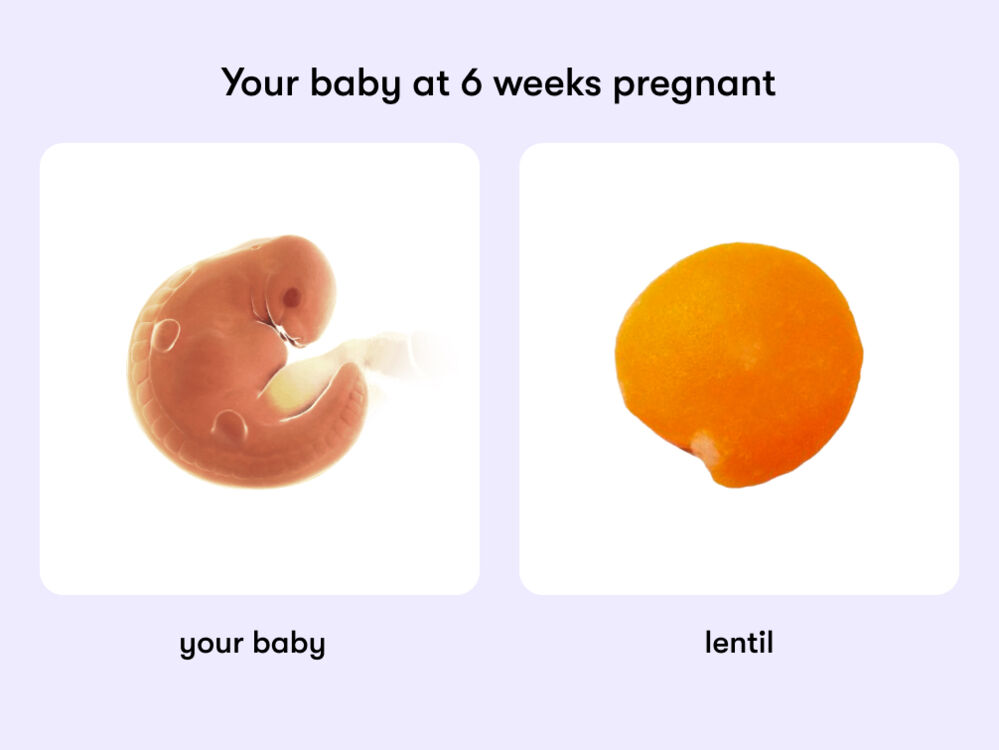 6 weeks pregnant: Symptoms, hormones, and baby development
