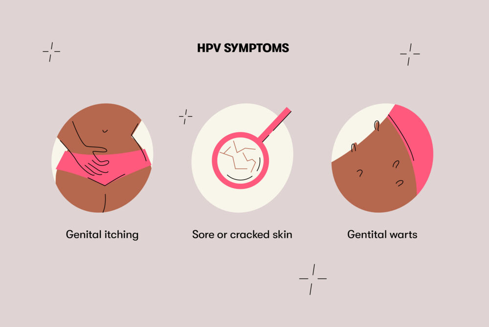 Symptoms of HPV