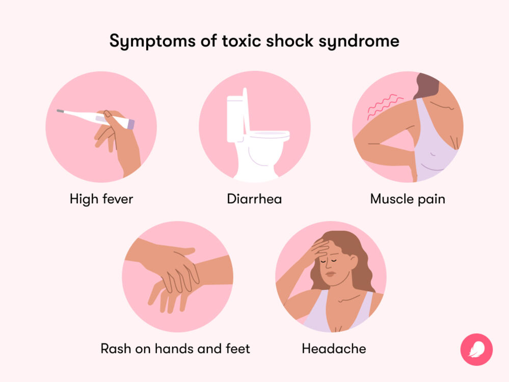 Symptoms of toxic shock syndrome