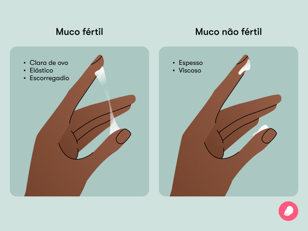 Uma ilustração mostrando a diferença entre o muco do período fértil e não fértil