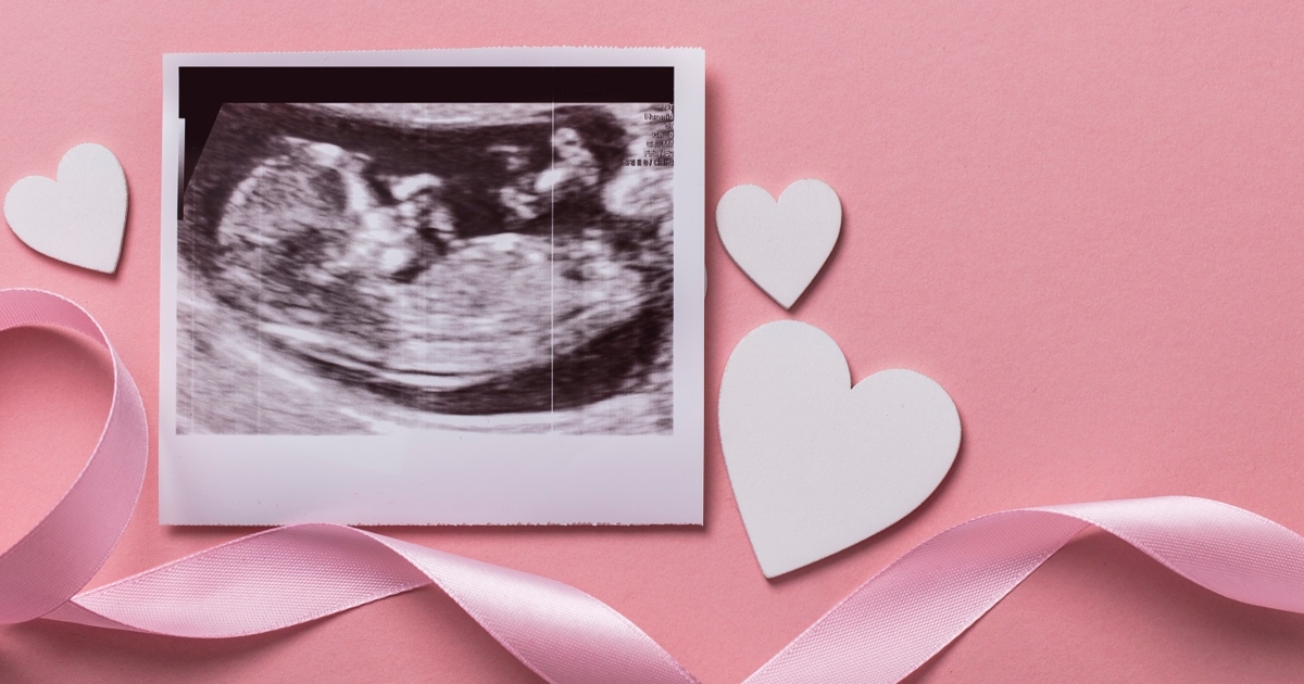 Fundal Placenta Position Is Placenta On Top A Problem Fundal Placenta Position Is Placenta On Top A Problem