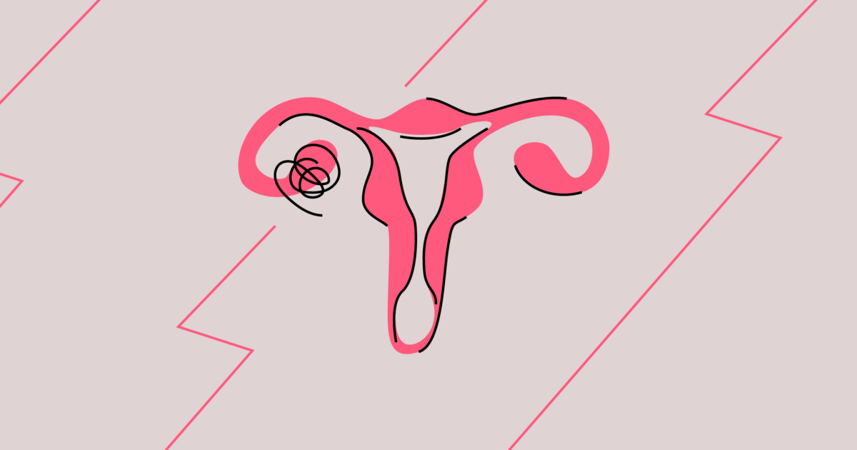 Ovary Pain What Does It Signal