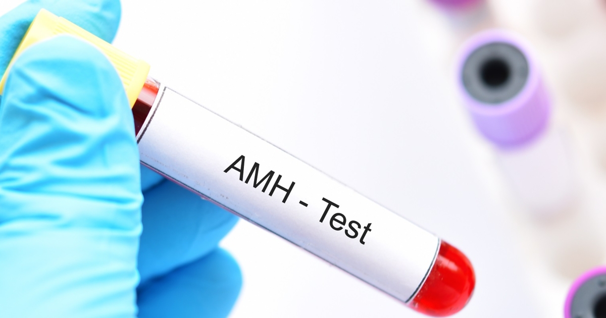 Anti-Müllerian Hormone Test: 6 Things You Should Know