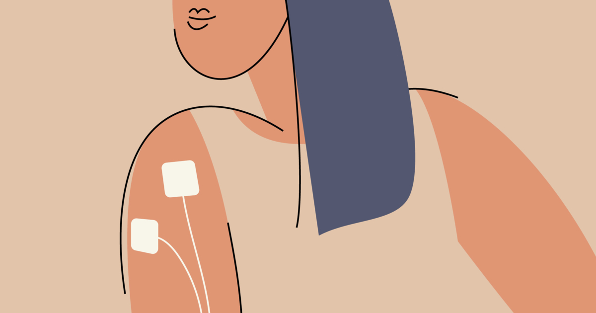 TENS Unit: The 'Natural Labor' Tool No One Is Talking About