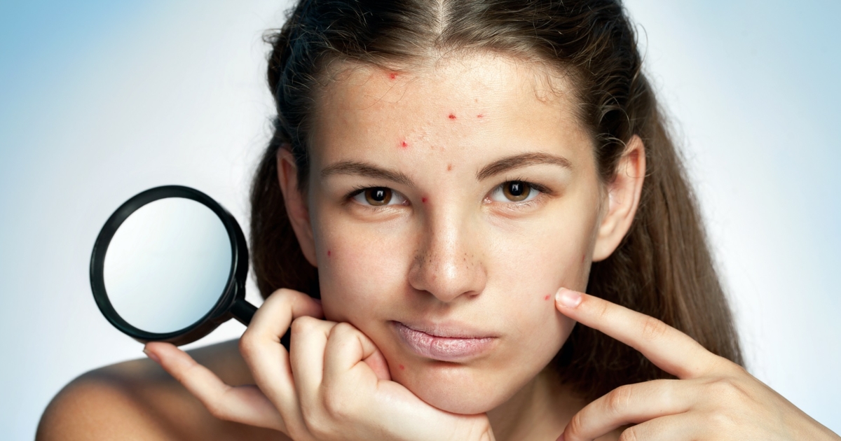 Spots, Dry, and Oily Skin: How Hormones Affect Your Skin Before and During  a Period