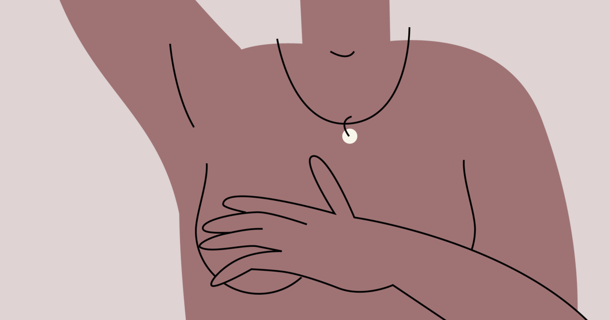 what causes sagging breasts