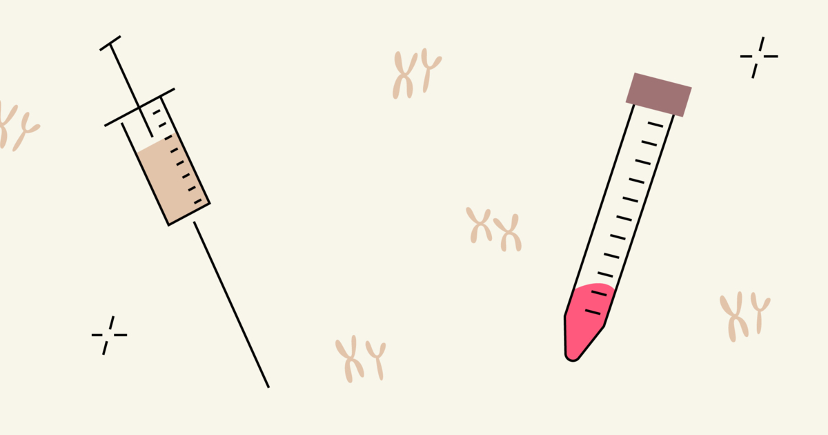 Chorionic Villus Sampling Cvs Vs Amniocentesis