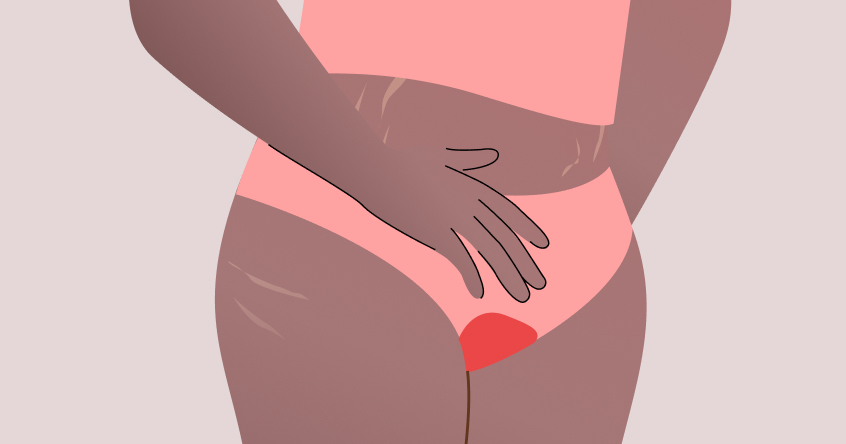 When I got my first period, why was the blood brown? - Quora