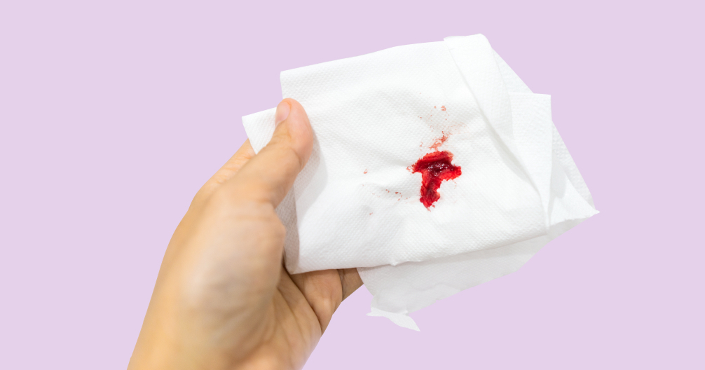 What is the color of your menstruation blood? FYI, the above post