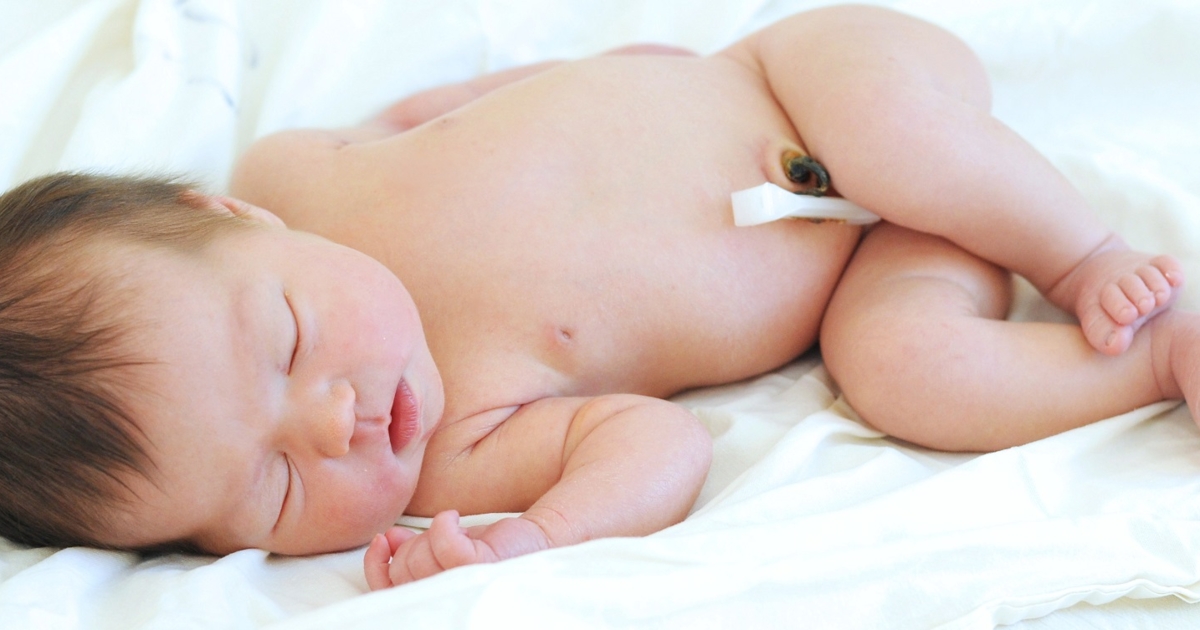 Umbilical Cord Care: An In-Depth Guide