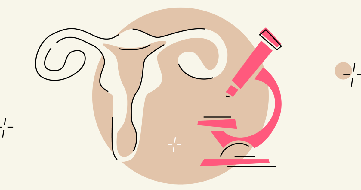 Colposcopy What to Expect from a Colposcopy Procedure