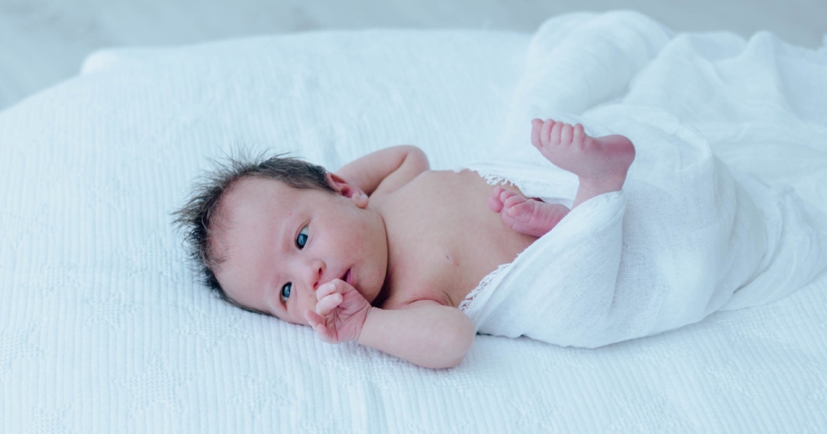 Cross Eyed Babies What Is Strabismus Treatment Cross Eyed Babies What Is Strabismus Treatment