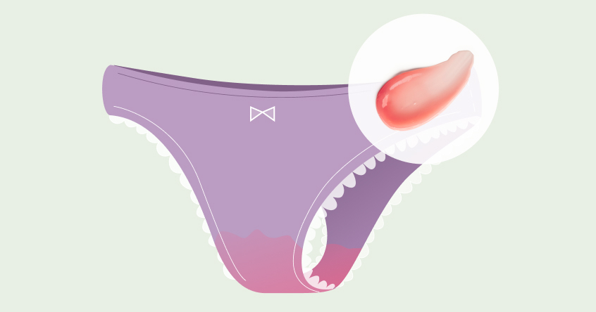 Sangramentos de escape e manchas entre menstruações