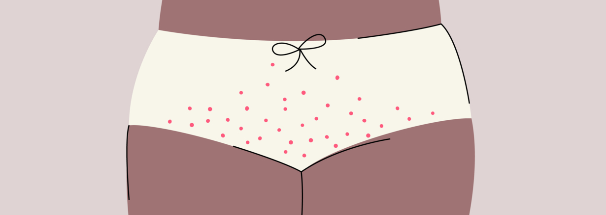 Crabs Or Pubic Lice How You Get Them And What To Do