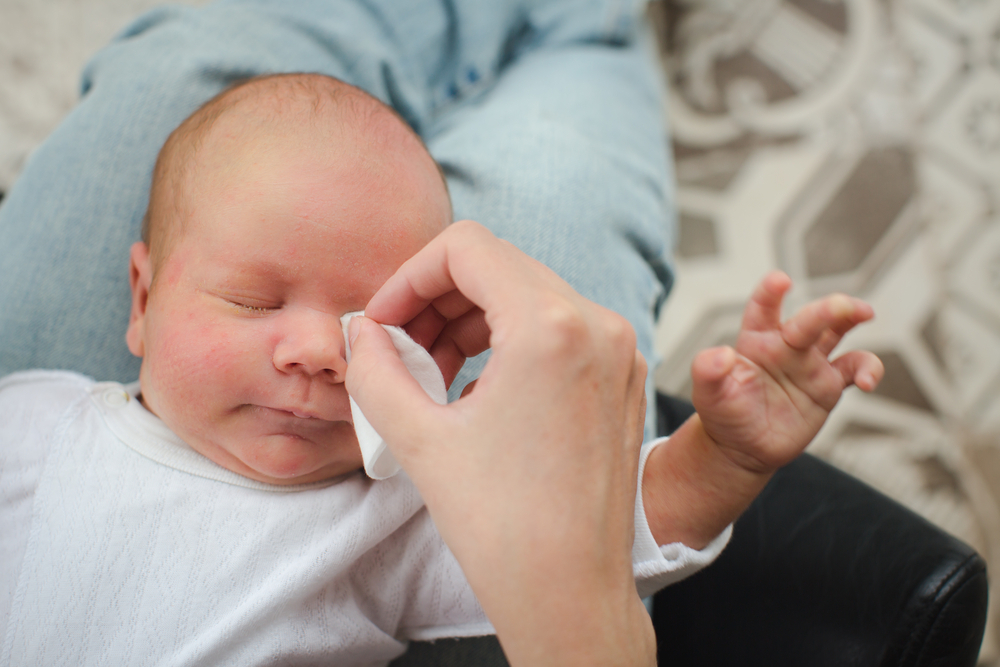 A mom cleans baby's eyes after appling eye ointment A mom cleans baby's eyes after appling eye ointment