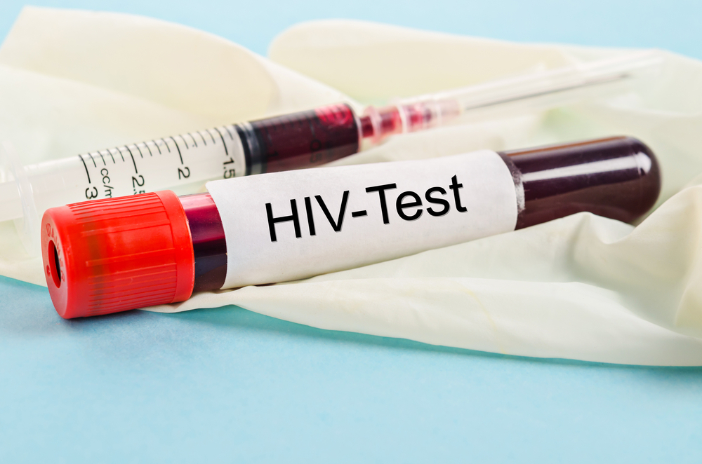 HIV test HIV test