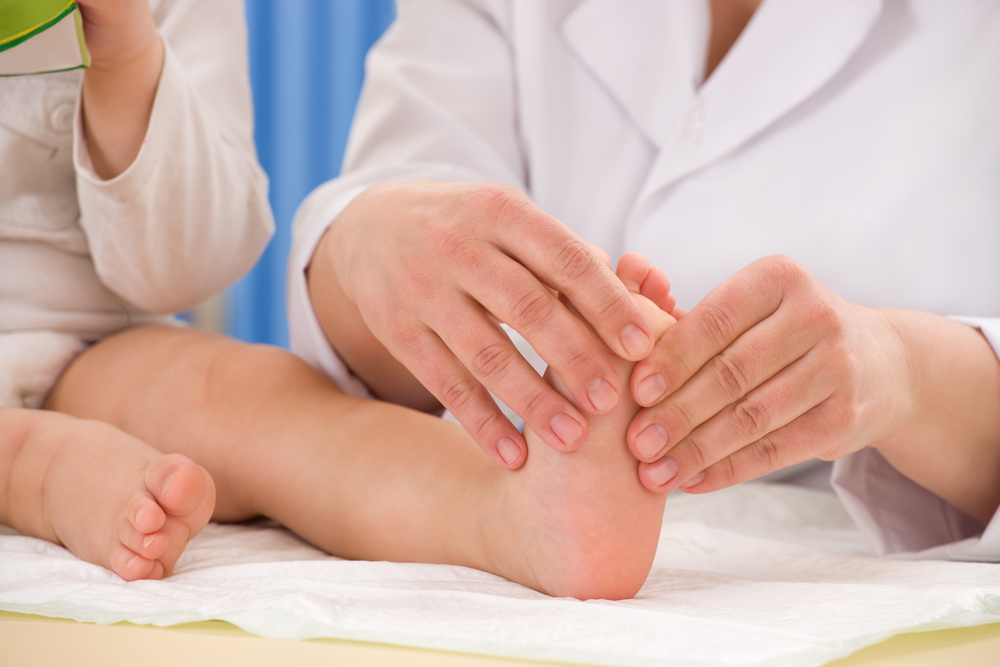 A toddlers with flat feet diagnosed by their pediatrician A toddlers with flat feet diagnosed by their pediatrician