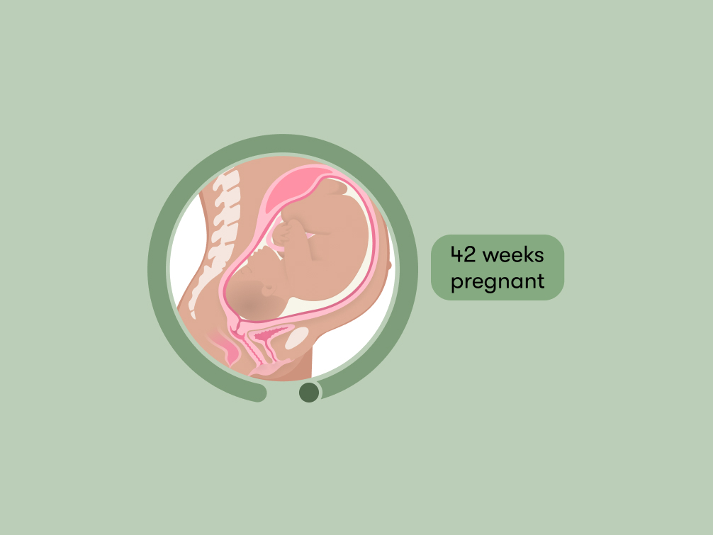42 weeks pregnant: Symptoms, tips, and baby development