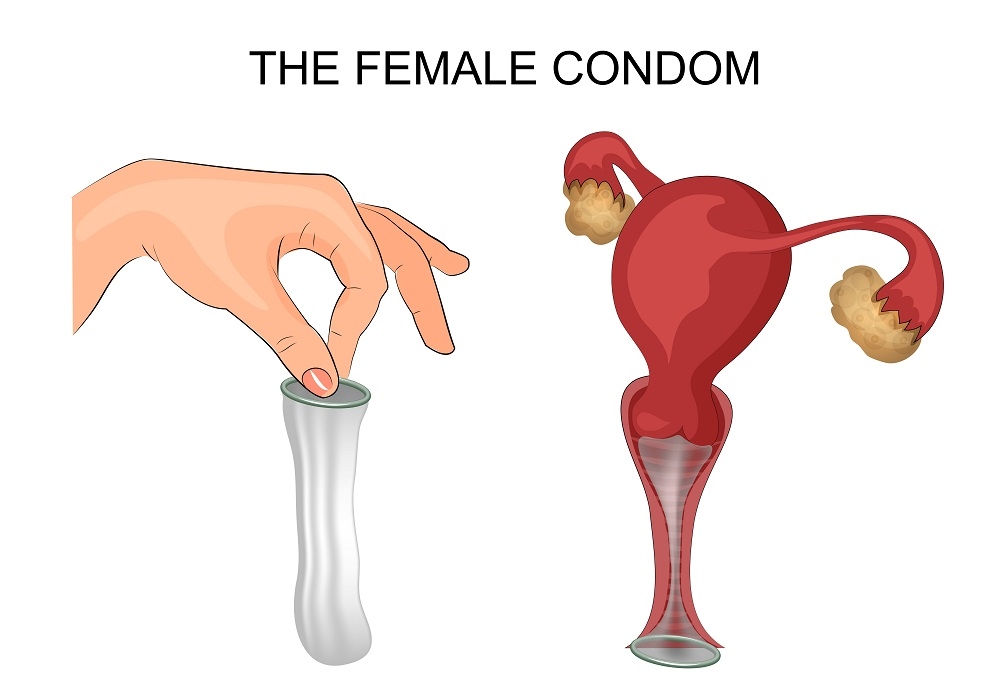 Female condom Female condom