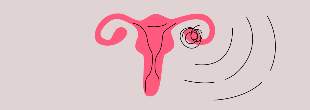 Ovary Pain During Pregnancy What Does It Mean