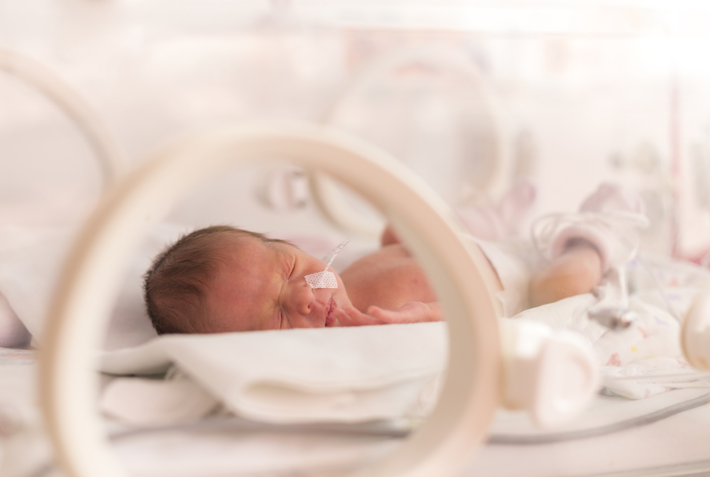 A baby born at 34 weeks A baby born at 34 weeks