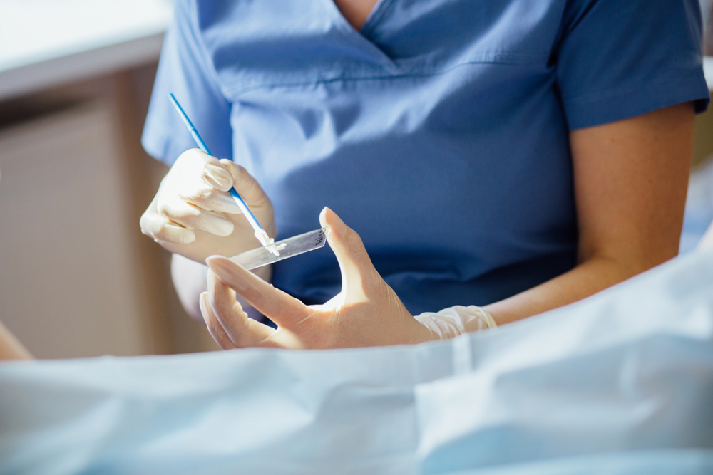 Doctor collects cervical cells during a Pap smear Doctor collects cervical cells during a Pap smear