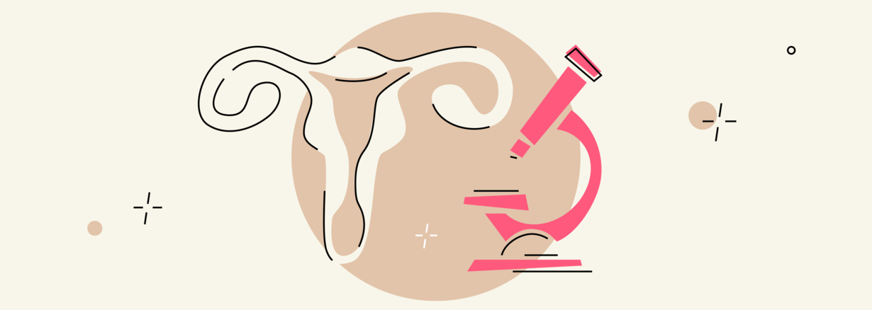 Colposcopy: What to Expect from a Colposcopy Procedure