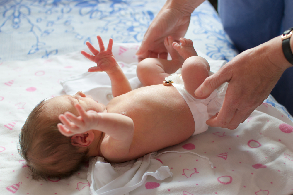 Moro reflex test Moro reflex test