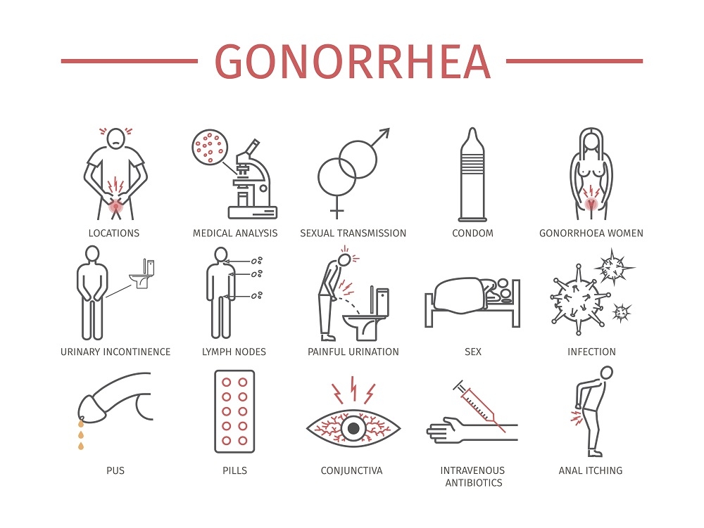 chlamydia and gonorrhea symptoms female