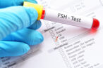FSH blood test